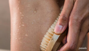 cellulite Causes hormonales, circulatoires, émotionnelles